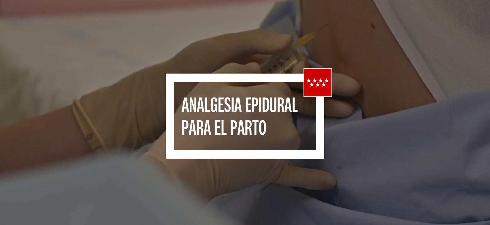 Miniatura del vídeo Analgesia epidural